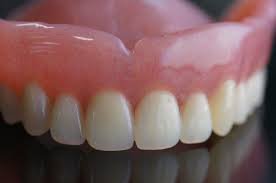 Affordable dentures